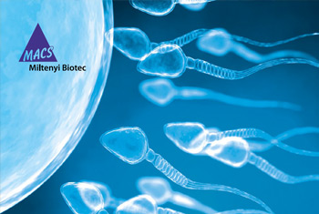 MACS – Magnetic Activated Cell Sorting